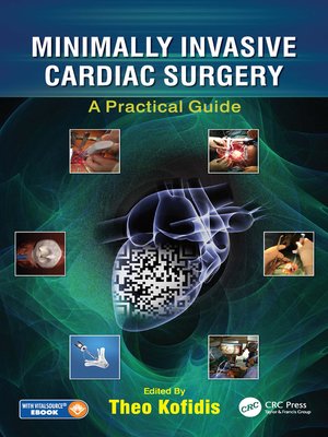 cover image of Minimally Invasive Cardiac Surgery